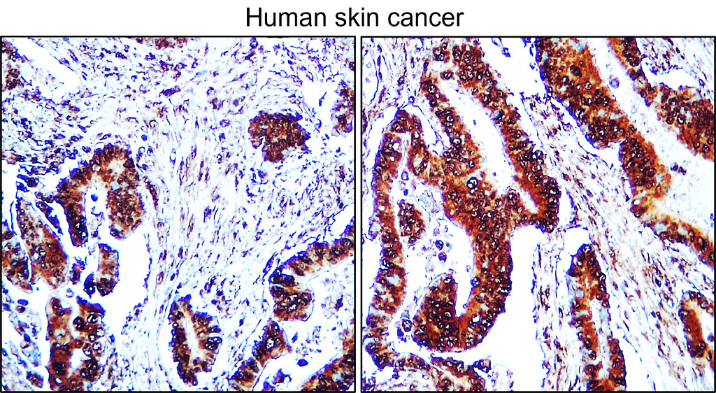  IRM321 IL1 beta antibody [MD5] IHC Image 