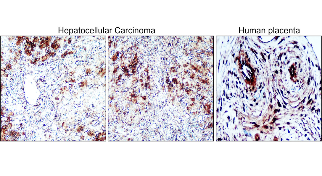 IRM311 Factor IX / F9 antibody [PB-3] IHC image