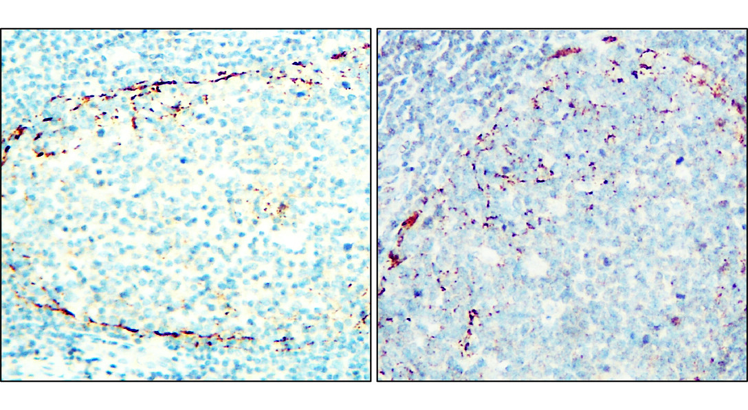 IRM014 NCAM-L1 / L1CAM monoclonal antibody [23B] IHC image