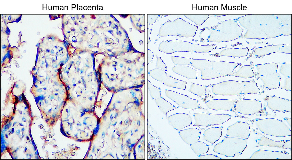 IR221-860 anti-MUC1 antibody IHC image