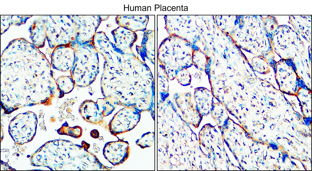 IR221-860 anti-MUC1 antibody IHC image