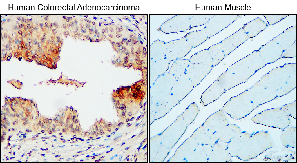 IR221-860 anti-MUC1 antibody IHC image