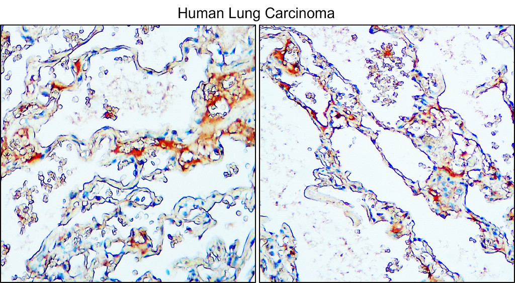 IR221-860 anti-MUC1 antibody IHC image