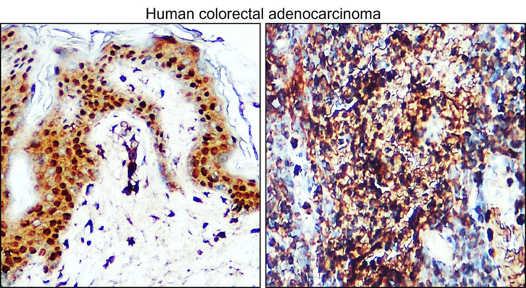 IR351-953 anti-CDX2 antibody IHC image