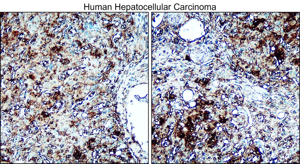 IRM216 Osteopontin / OPN antibody [C1H3] IHC Image