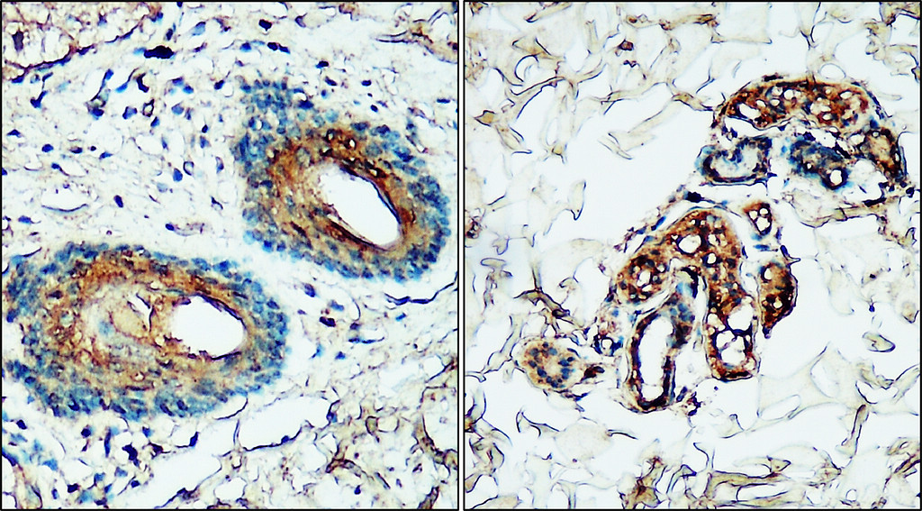 IRM314 TNF alpha antibody [PE-6] IHC image