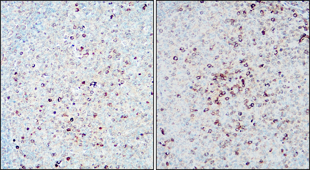 IR212-1 Ki-67 antibody IHC image