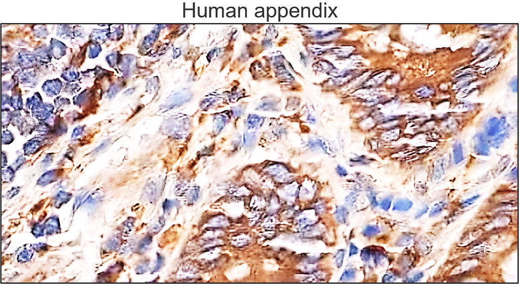 IRM024 NOX2 gp91phox, monoclonal antibody  IHC image