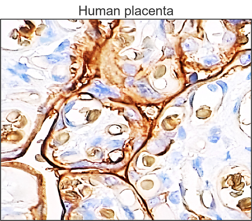 IRM026 GLUT1 Glucose Transporter, monoclonal  antibody IHC image