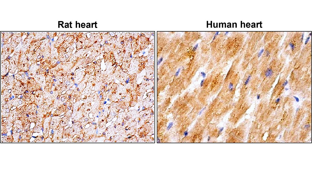 IRM027 GLUT4 Glucose Transporter, monoclonal antibody  IHC image 