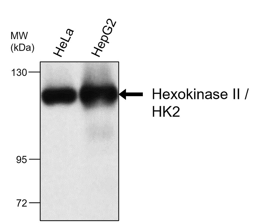 IRM028 Hexokinase II / HK2,  monoclonal antibody WB image