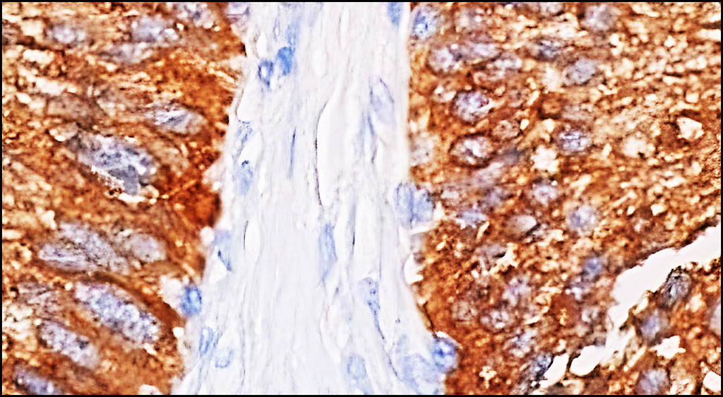 IRM028 Hexokinase II / HK2,  monoclonal antibody IHC image