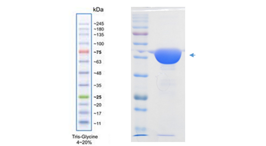 IRRP7006_Enolase-2 / NSE Recombinant Protein, Human