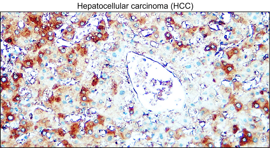 IRM405 AIF / M1monoclonal antibody  IHC Image 