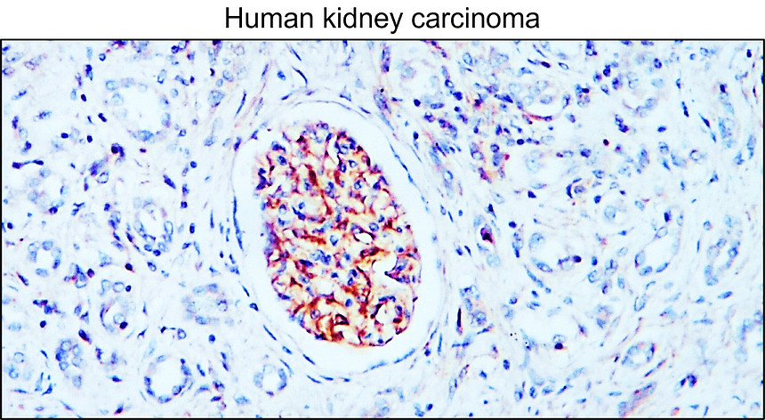 IR8-23 anti-Nestin antibody IHC image