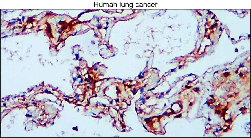 IR111-456 anti-Carbonic Anhydrase IX / CA-IX  antibody IHC image 