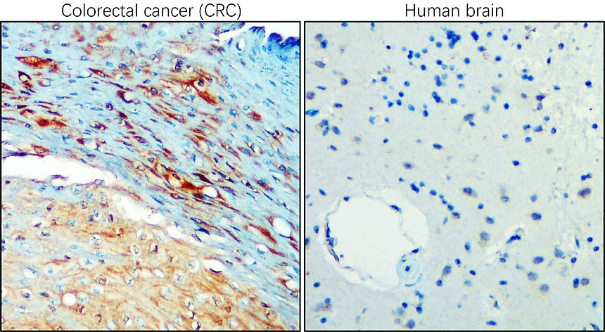 IR111-456 anti-Carbonic Anhydrase IX / CA-IX  antibody IHC image 