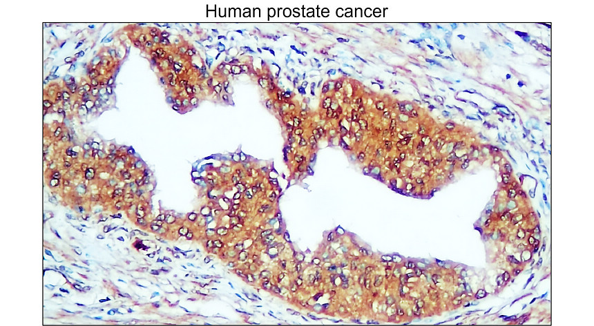 IR111-456 anti-Carbonic Anhydrase IX / CA-IX  antibody IHC image 