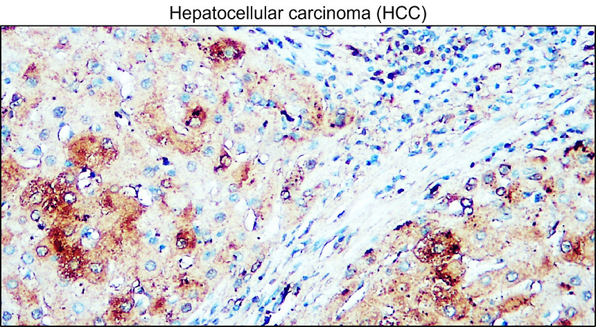 IRM405 AIF / M1monoclonal antibody IHC Image