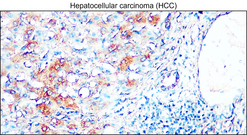 IRM405 AIF / M1monoclonal antibody IHC Image