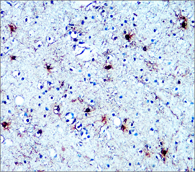 S100B antibody