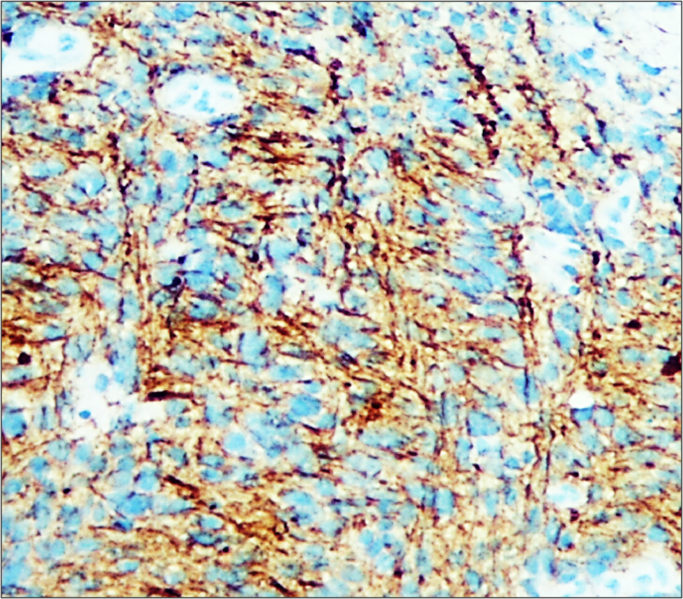 NSE / Enolase-2 antibody