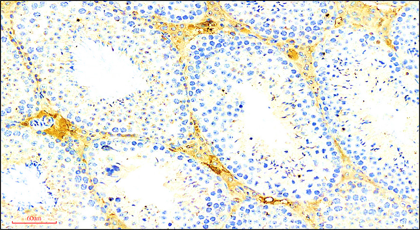 Customer feedback Image IR57-195 anti-Occludin antibody IHC image