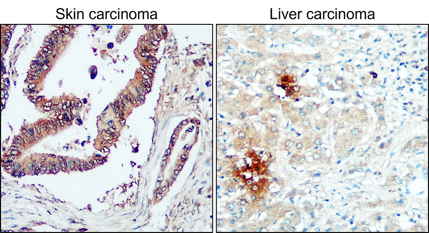 IR289-955 anti-CTGF antibody IHC image