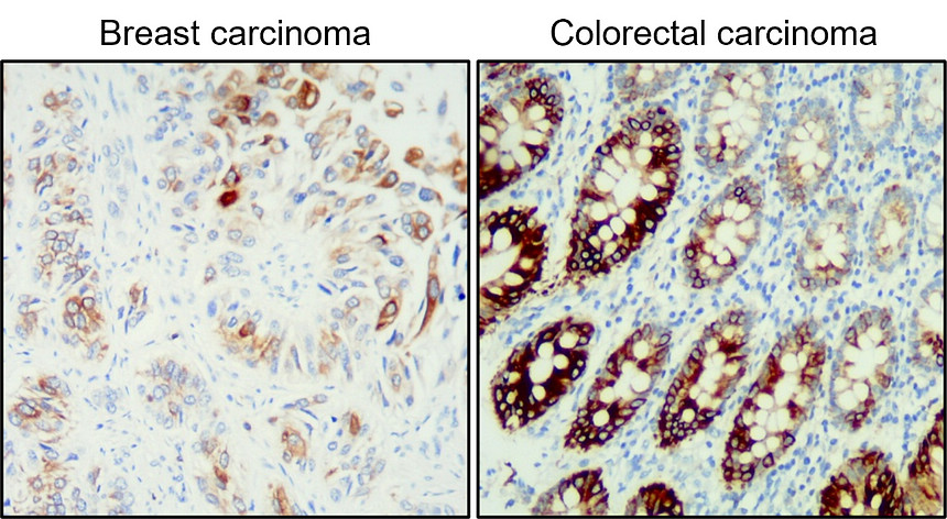 IR238-892 anti-Cytokeratin 20 antibody IHC image