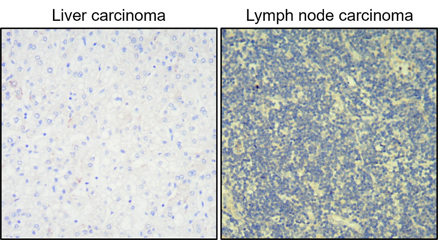 IR238-892 anti-Cytokeratin 20 antibody IHC image