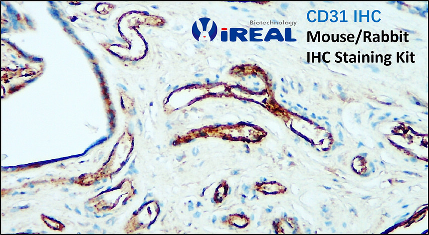 CD31 IHC, Mouse/Rabbit  IHC Staining Kit