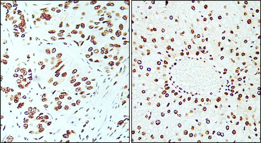 IR212-772 anti- Ki-67 antibody IHC image