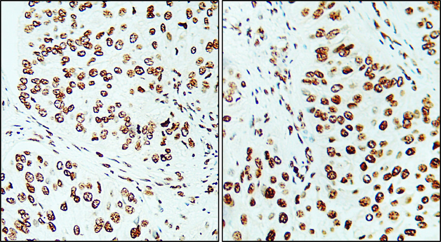 IR212-772 anti- Ki-67 antibody IHC image