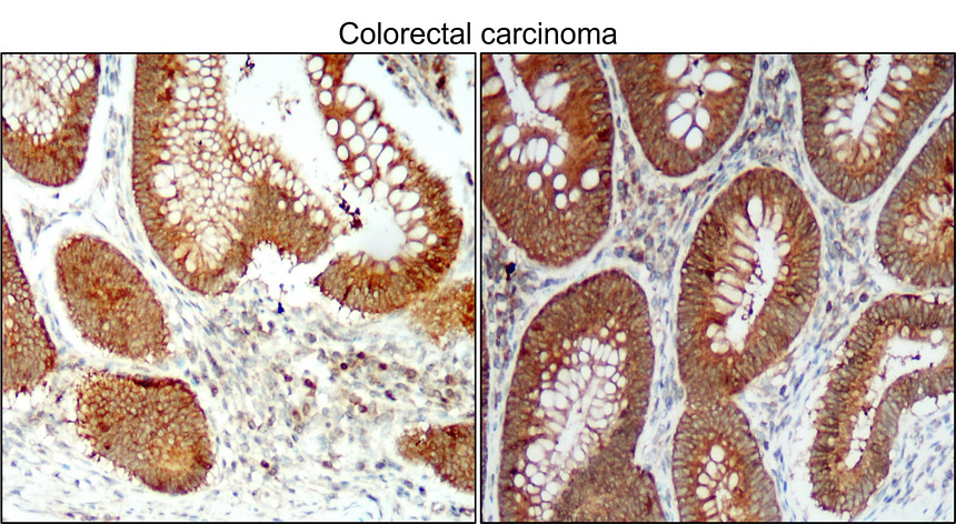 IR94-392 anti-BCL2 antibody  IHC image 