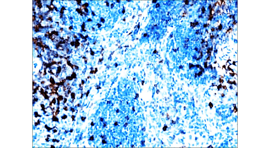 IRR006 mouse CD8a antibody [53- 6.7] IHC image 