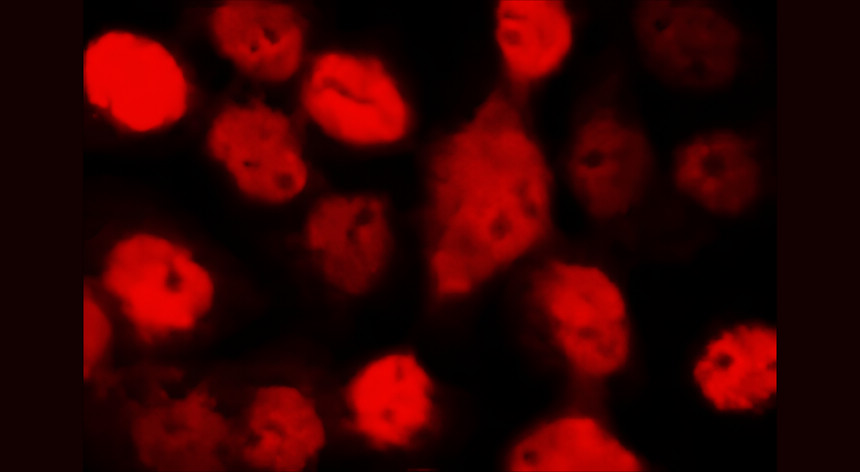 IRFS4132. Mouse anti-rabbit IgG, Texas red conjugated ICC/IF image.