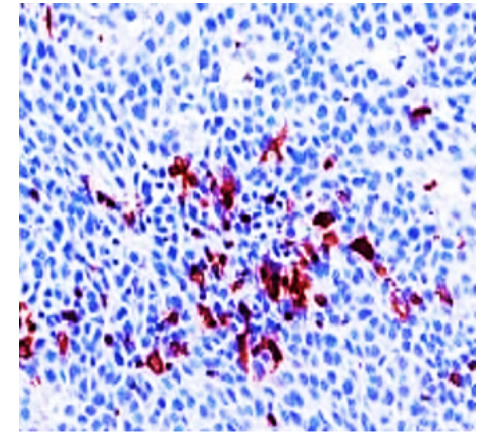 CD11b antibody