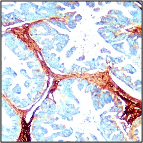 Collagen I antibody