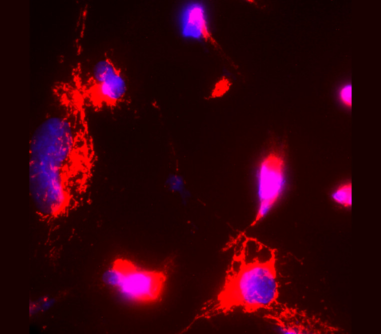 iNOS antibody