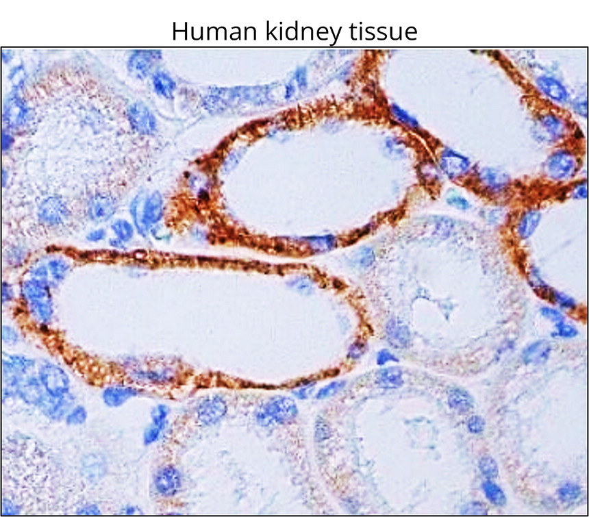 IRM046 TSG101, monoclonal antibody IHC image