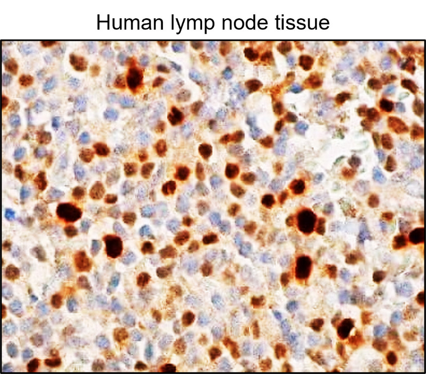 IRM047 RUNX2, monoclonal antibody IHC image