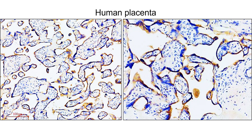 IR283-P1 anti Nectin-4 / PVRL4 antibody IHC image